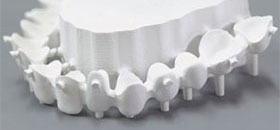 Zircone stratifié